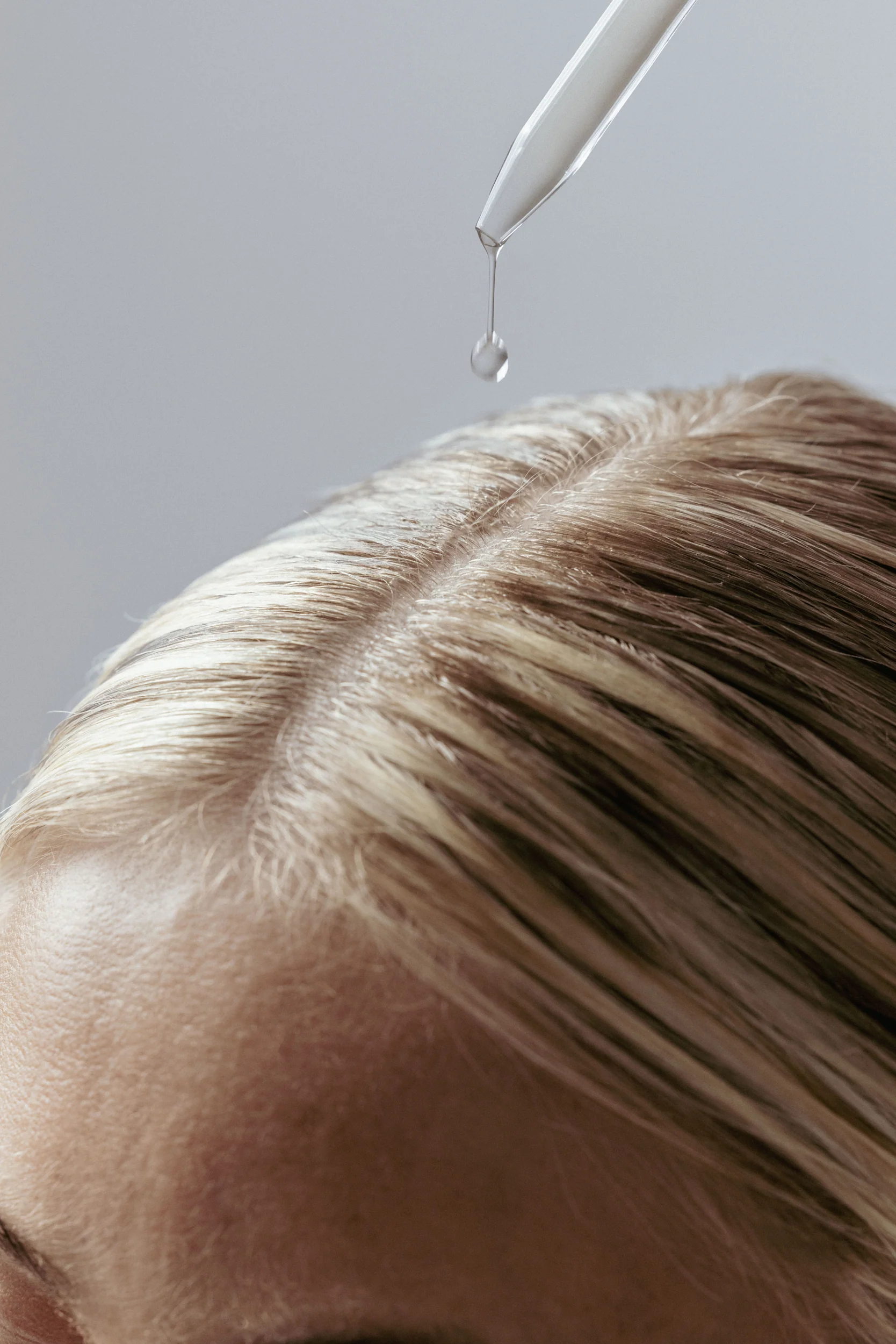 Fresh Start Anti-Dandruff Scalp Serum - Image 4